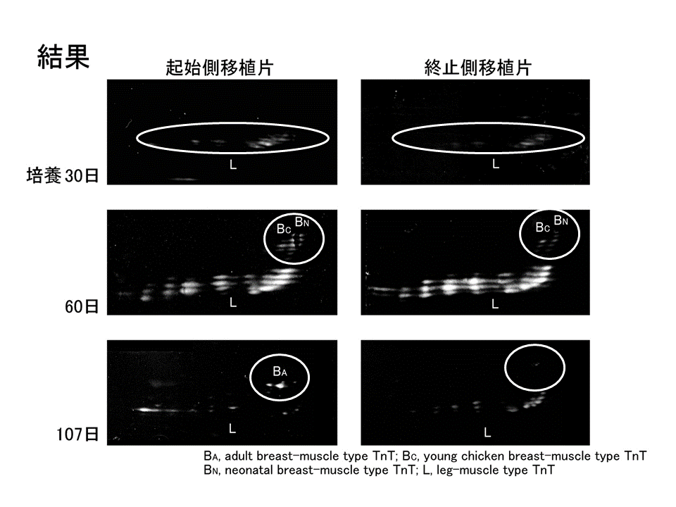 砂嚢